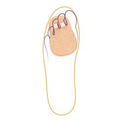 СТ-222 Корректор 2 пальцев